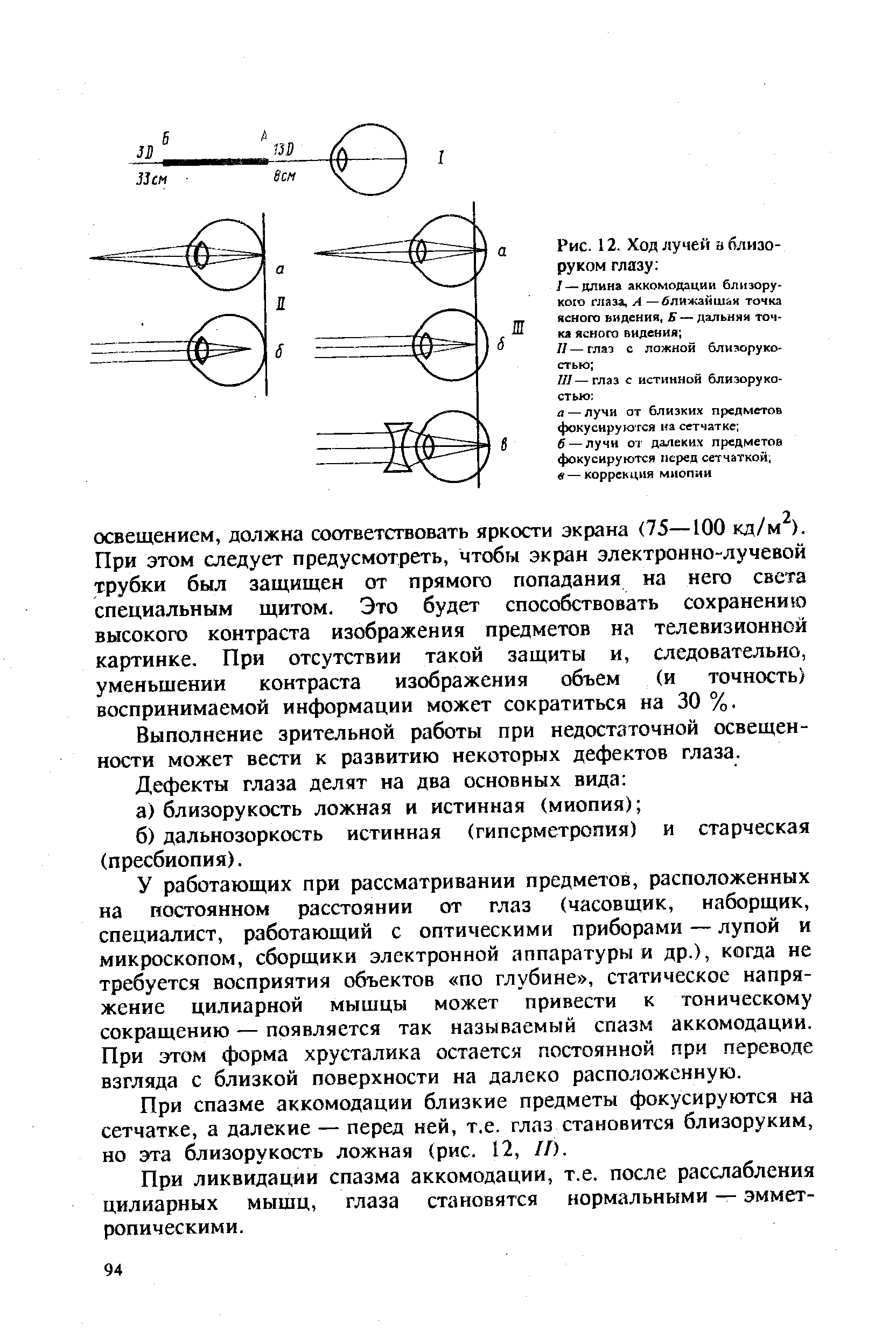 Дополните утверждения изображение в близоруком глазу