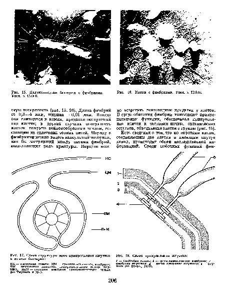 Кокки с фимбриями. Увел. X 12 000.