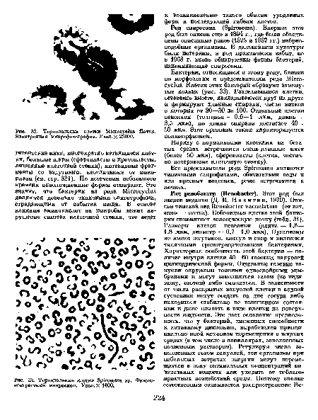 Тороидальные клетки 8р1гозоша ер. Фазовоконтрастный микроскоп. Увел. X 1600.