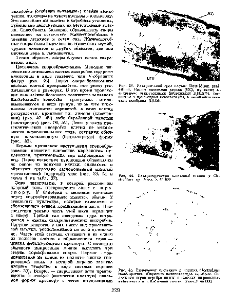 Ультраструктура клеточной стенки у Clostridium sp. Увел. X 45 ООО.
