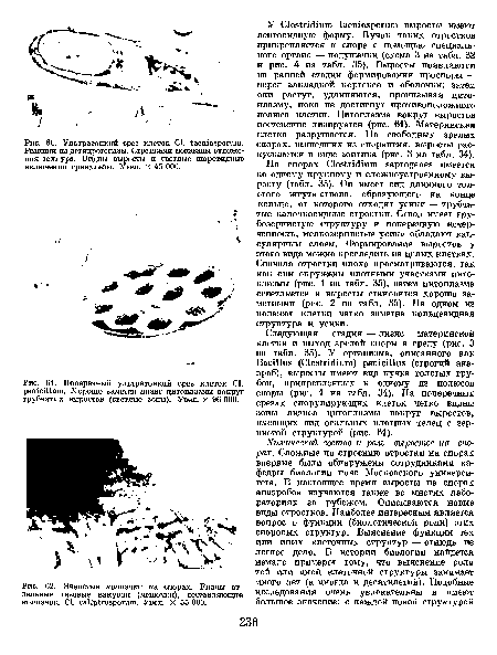 Поперечный ультратонкий срез клеток С1. решсШит. Хорошо заметен лизис цитоплазмы вокруг трубчатых выростов (светлые зоны). Увел. X 96 ООО.