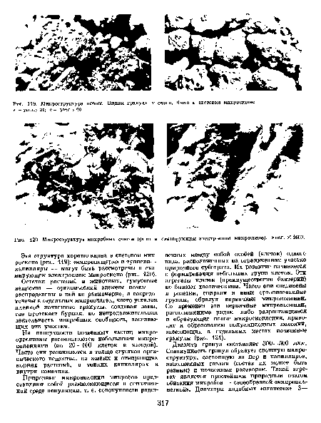 Эта структура хорошо видна в световом микроскопе (рис. 119); «микропещеры» и туннели-капилляры — могут быть рассмотрены в сканирующем электронном микроскопе (рис. 120).