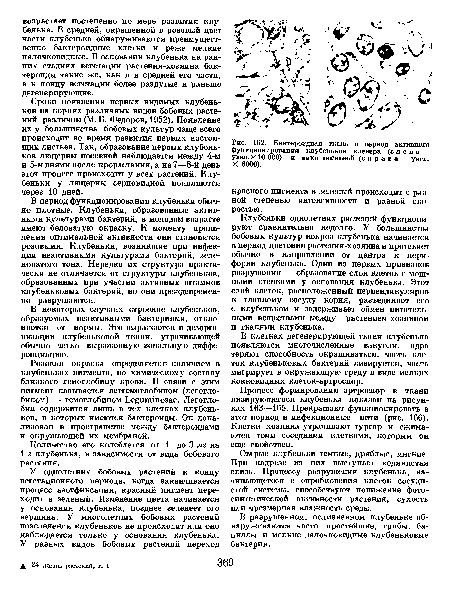 Бактероидная ткань в период активного функционирования клубеньков клевера (слева — увел. X10 ООО) и вики посевной (справа — увел. X 6000).