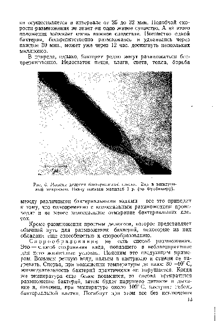 Момент деления бактериальной клетки. Вид в электронный микроскоп. Внизу показан масштаб 1 ц (по Фробишеру).
