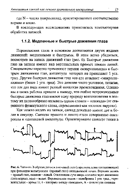 Типичный образец записи движений глаз (горизонтальная составляющая) при фиксации испытуемым (правый глаз) неподвижной точки. Верхняя запись - правый глаз, нижняя - левый. Отклонение луча вверх соответствует движению глаза вправо, вниз - влево. Вертикальная линия - калибровка 1 угл. град., горизонтальная - время 1с, I - интервал между саккадами, А - амплитуда саккады