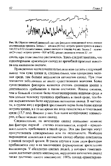 Образцы записей движений глаз при фиксации неподвижной точки лицами со сниженным зрением. Запись 1 - женина (61 год)