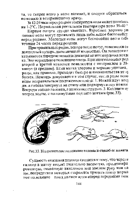 Неправильное положение головы и способ ее захвата