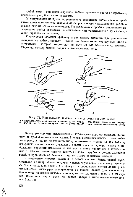 Исследование яичников и матки через прямую кишку